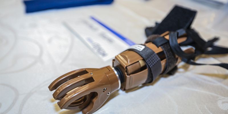 Cundinamarca transforma vidas con entrega gratuita de prótesis de miembro superior